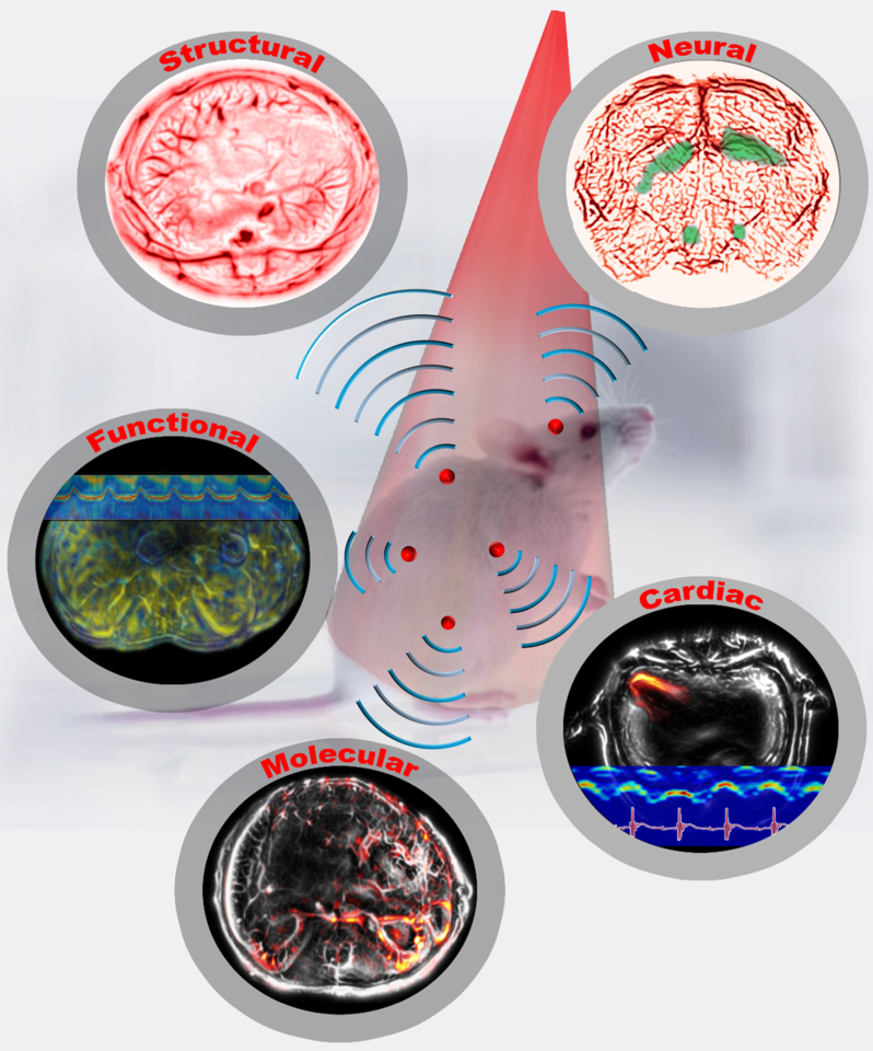 Single-impulse Panoramic Photoacoustic Computed Tomography of Small-animal Whole-body Dynamics at High Spatiotemporal Resolution